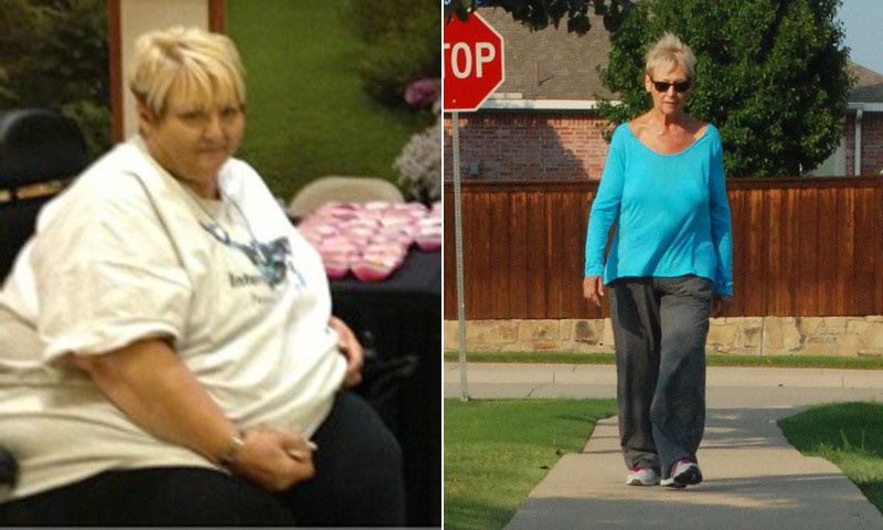 Удивительные истории и фото людей, сбросивших лишний вес (10 фото)