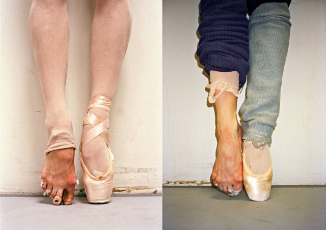 Как выглядят ноги профессиональных балерин (8 фото)