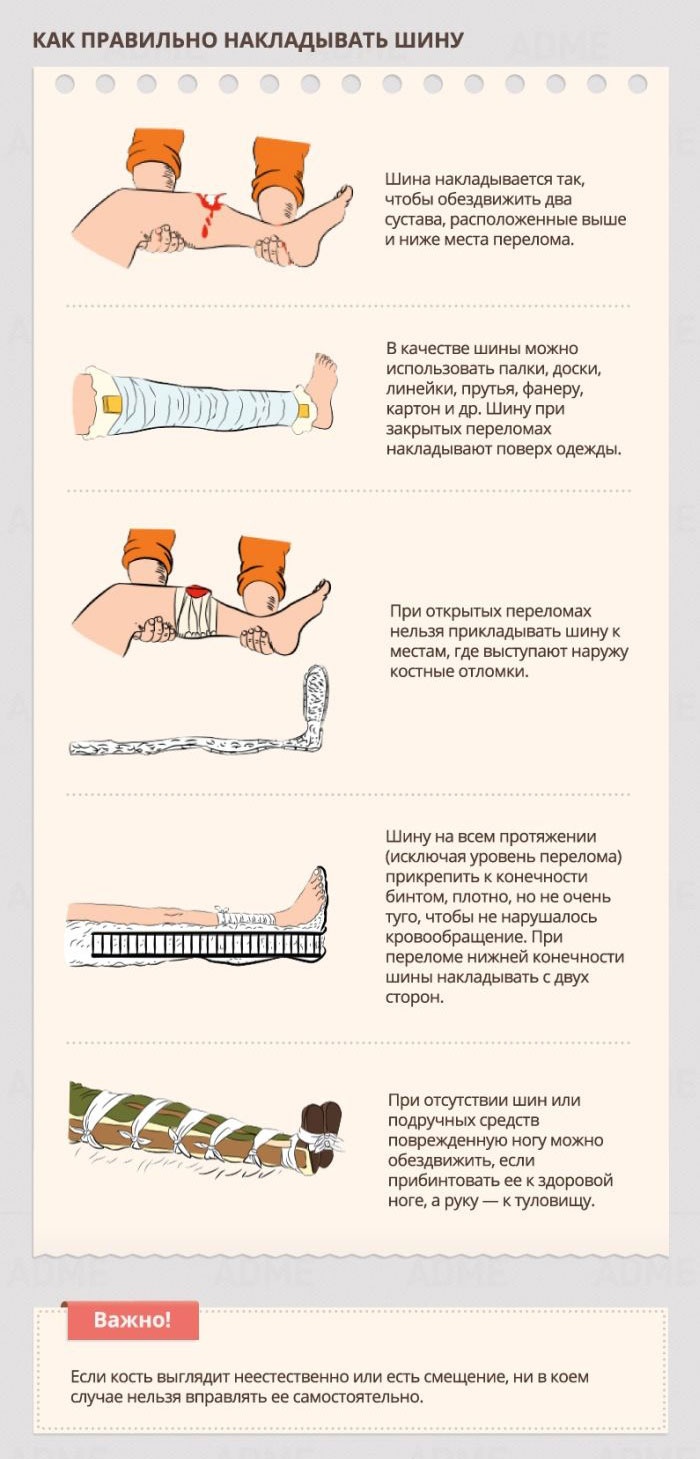 Рекомендации по оказанию первой медицинской помощи (21 картинка)