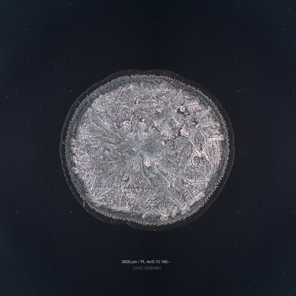 Слезы под микроскопом (19 фото)