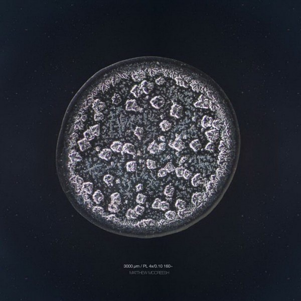 Слезы под микроскопом (19 фото)