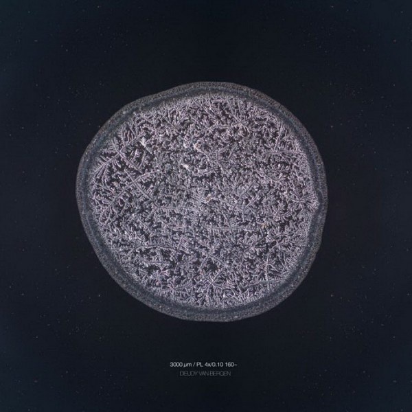 Слезы под микроскопом (19 фото)