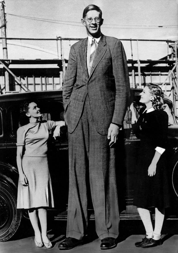 Роберт Уодлоу - самый высокий человек (14 фото)