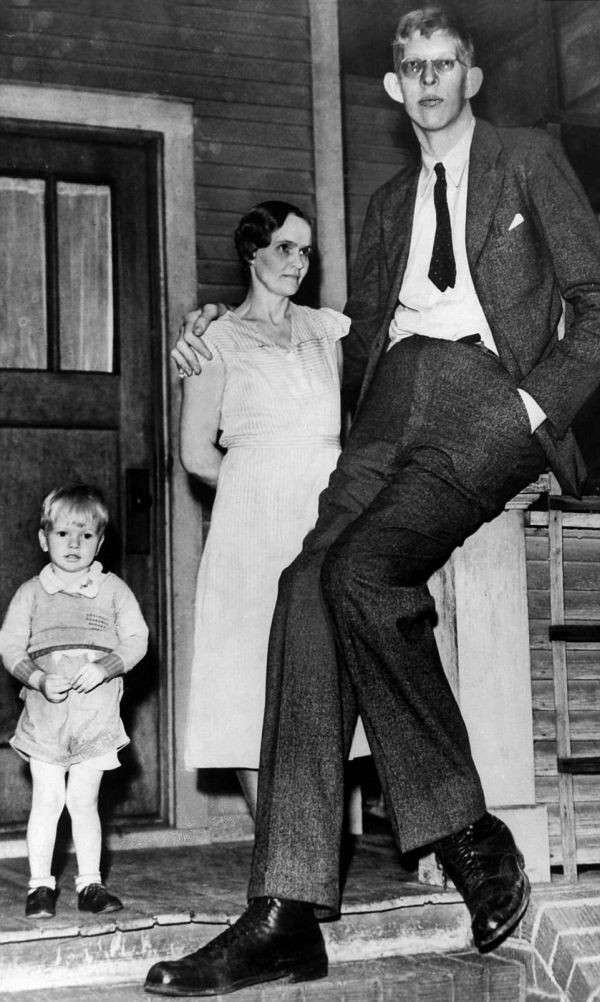 Роберт Уодлоу - самый высокий человек (14 фото)