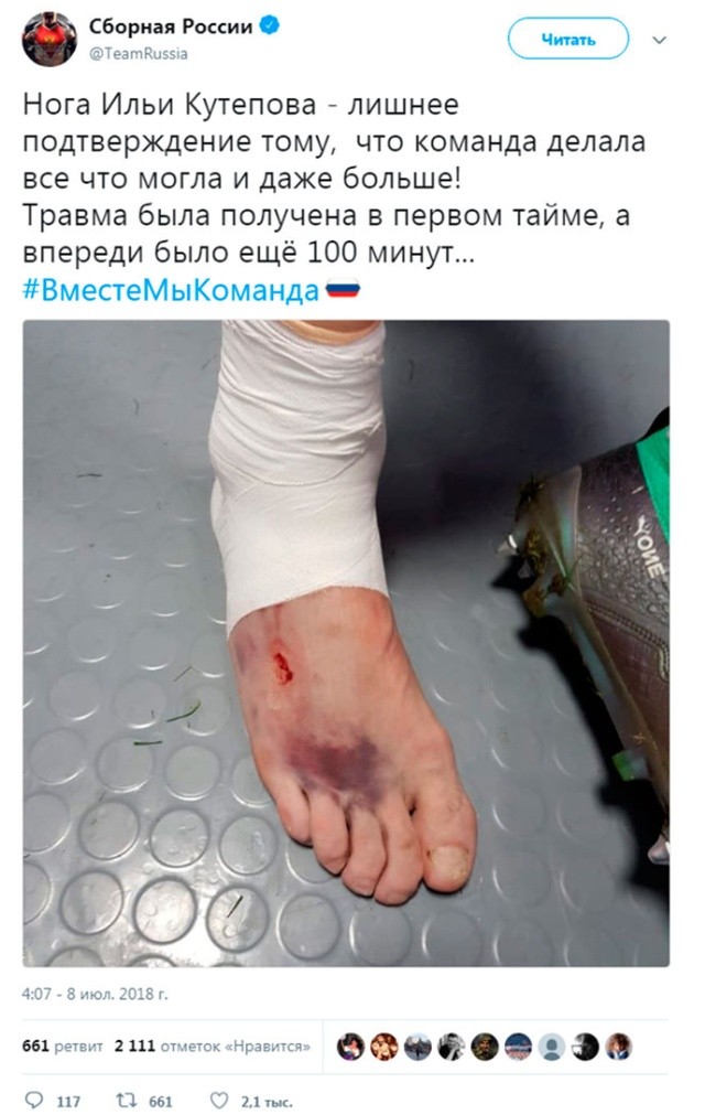Кутепов играл матч "Россия - Хорватия" с серьезной травмой (2 фото)