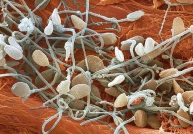 Фото человеческих органов под микроскопом