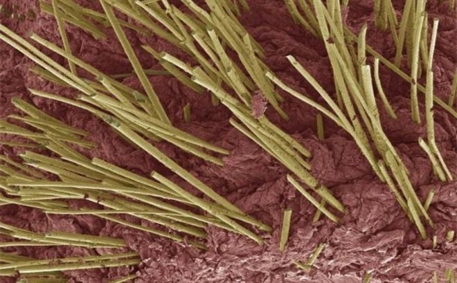 Фото человеческих органов под микроскопом